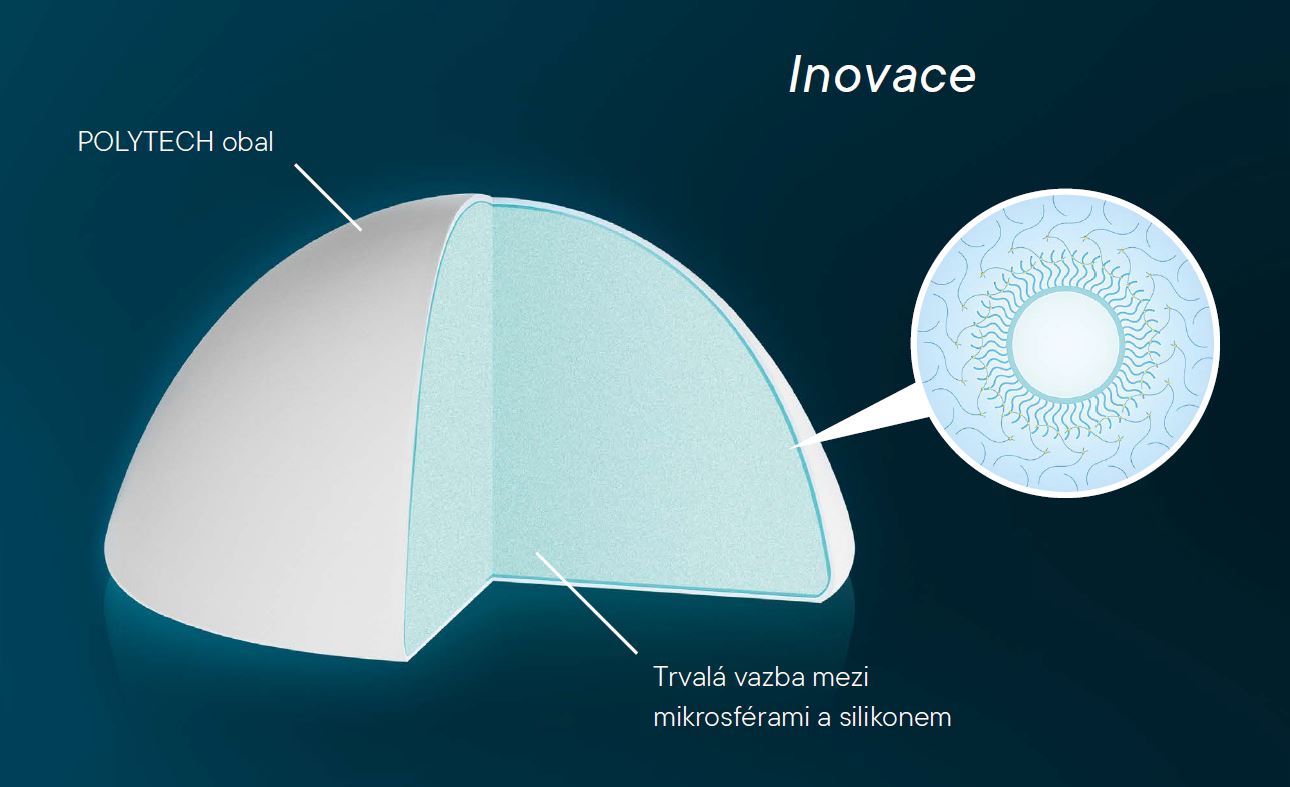 B-Lite® Odlehčené Prsní Implantáty Pro Augmentaci I Sanimpo Spol. S R.o.